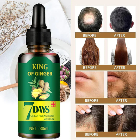 🚨GRAN LANZAMIENTO⚡️ - SERUM JENGIBRE ANTI CAIDA Y CRECIMIENTO ACELERADO 7DAYS - ¡COMPRE 1 Y LLÉVESE 2 GRATIS! 🎁